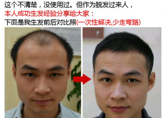 乌臣谷老师是真是假?谁用过?有副作用吗?【靠谱吗】