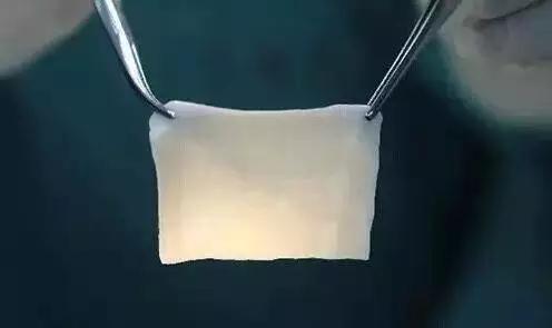(图为生物补片)