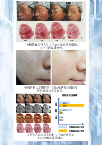 投资瑞士氧皙水光枪加盟创业能赚钱吗