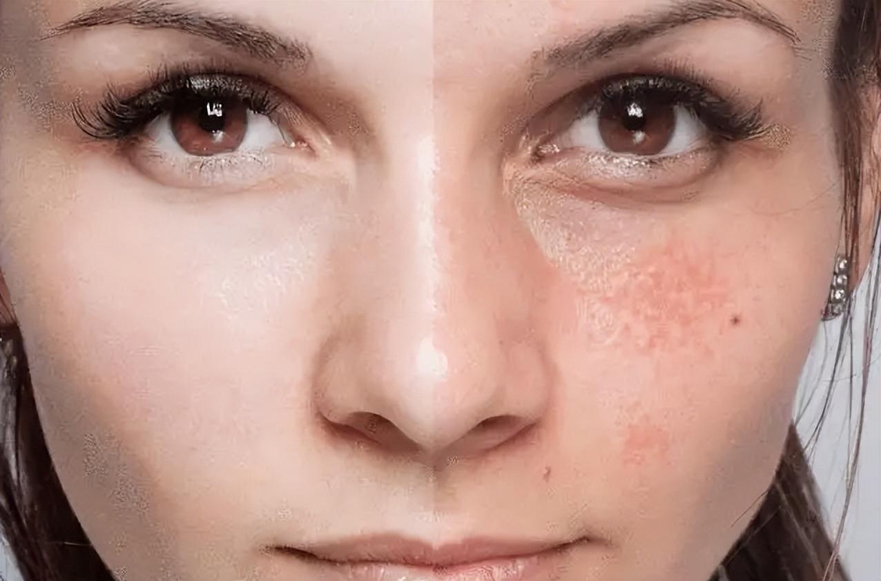 艳存胶原水光竟成了“情绪灭火器”？专治那张一碰就“上头”的脸！