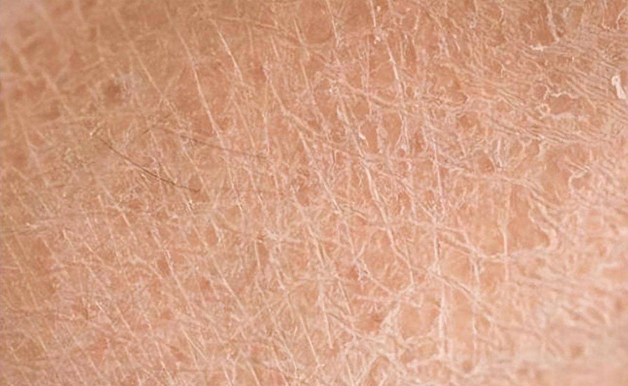 皮肤闹“旱灾”？艳存胶原水光一招打通“输水管”，水润到能掐出水